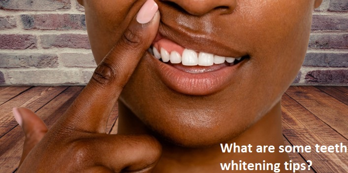 Teeth whitening and periodontitis: Does teeth whitening cause any dental problems?